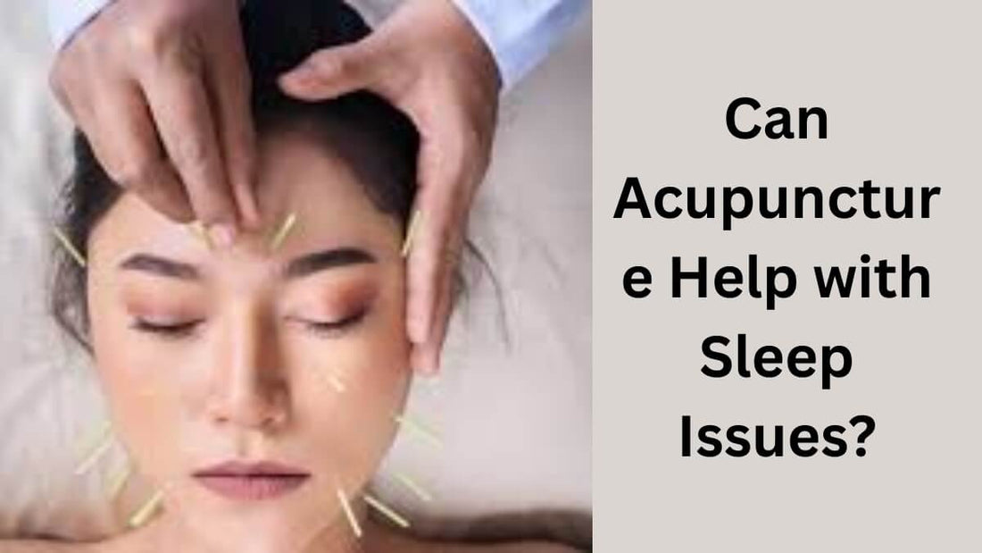 Can Acupuncture Help with Sleep Issues?