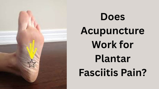 Does Acupuncture Work for Plantar Fasciitis Pain?