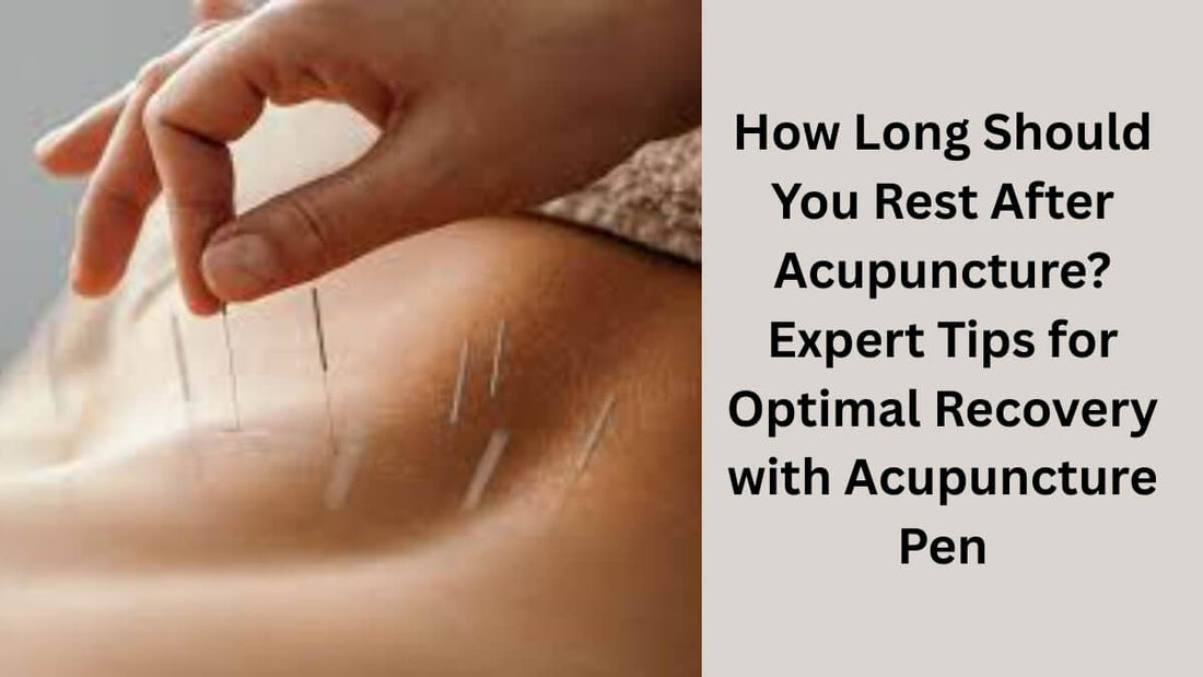 How Long Should You Rest After Acupuncture?